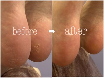 サロン ロダン(SALON RODAN)/before→after