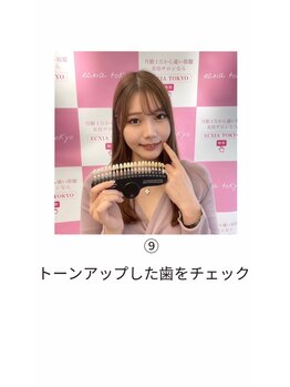 エクシアホワイト 山形西バイパス店/ホワイトニング施術の流れ