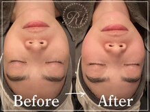 R-1ビューティーサロン 表参道/Before＆After