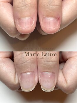マリーロール 淀屋橋本店(Marie Laure)/自爪育成/深爪矯正/ネイルケア