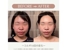 アイミーボーテ(Aime beaute)/《コルギ》