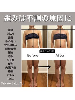 ソル(Sol)/美骨メソッド　before＆after