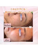 メリー 大和八木店(merry)/長年のお悩みも改善★