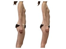 ベンザイ 新潟店(BENZAI)/腰痛に悩むパソコン女子