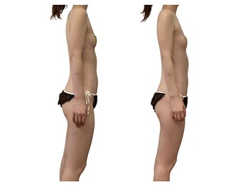 ベンザイ 新潟店(BENZAI)/腰痛に悩むパソコン女子