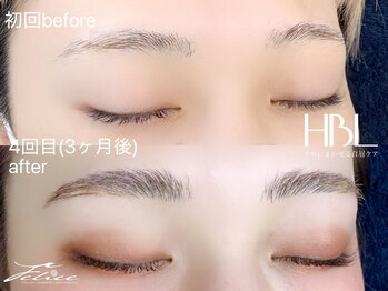 フェリーチェ(Felice)/ズダ眉3ヶ月眉いく☆HBL