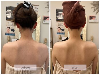 リバース(Rebirth)/首、肩甲骨のラインに注目！！