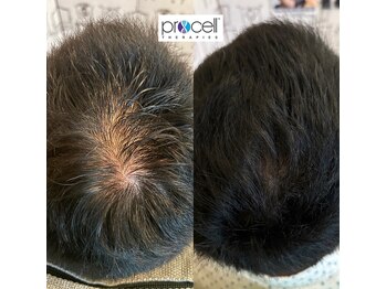 ワンブルーム(OneBloom)の写真/【頭皮育×肌育】4冠受賞の最先端頭皮ケアでメンズのお悩みを徹底改善！人生が変わる体験を◎