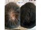 ワンブルーム(OneBloom)の写真/【頭皮育×肌育】4冠受賞の最先端頭皮ケアでメンズのお悩みを徹底改善！人生が変わる体験を◎