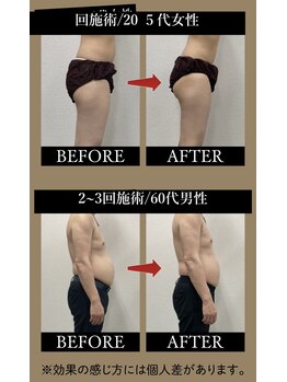 リリ(RiRi)の写真/理想の美ボディを実現へ！寝るだけ楽ちんケアでリバウンドをしない体を目指す♪
