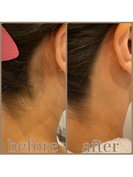 ファビー(Fabby)/シェービング(襟剃り)