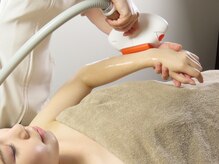 アルセ/【脱毛】