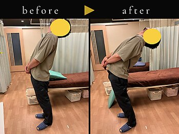 杉本接骨鍼灸院/背骨から全身がユルユル整体