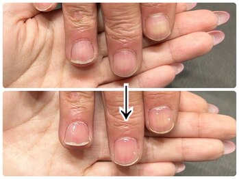 ネイルサロン イツキ(itsuki)/お爪のケアのお話し