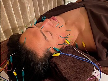 サス(SASU)の写真/国家資格者在籍★ルート鍼×電流でもたついたフェイスラインを引き上げ！納得の結果出しで高リピーター率◎