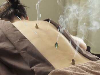 カイラス鍼灸院の写真/慢性的な疲れや不調に、じっくり寄り添う本格施術。鍼灸・指圧・カッピングを組み合わせ、全身を整えます◎