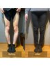 【初回限定】美脚を目指すなら！O脚・X脚矯正コース60分 ¥8,000→4,500