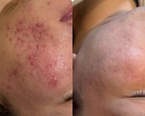 ナトゥーラ(NatuLa)