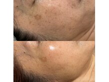 ヨルエステ(yoru aesthe)の雰囲気(サロンケア+ホームケアでエイジングのお悩みも解決)