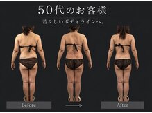 サロン グレイス(salon GRACE)の雰囲気(50代のお客様もどんどん若々しく姿勢で印象+腹部が一気に変わる)