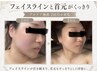 [1周年記念/おかえり輪郭]フェイスライン集中ケア￥5900→￥3900