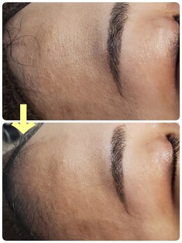 マニル アンド ネトラ(manil & netola)/ハイドロスプラッシュコース