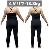 アネモネ