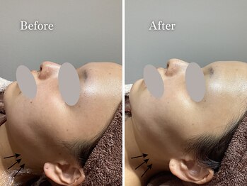 エリー(Ellie)/結婚式前直前1回プラン♪