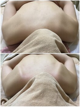 エヌエー(na)/バスト専用筋膜リリースケア