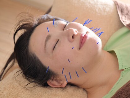 ハートフル鍼灸院の写真