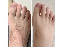 ミイン 宮代(MIIN)の雰囲気(優れた冷却機能で痛みを抑え、濃い毛もしっかり抜きます!)