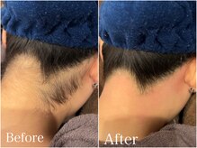 ジョエルワックス 沖縄那覇店(JOELLE WAX)/うしろ姿から綺麗に♪