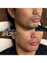 ジョエルワックス 沖縄那覇店(JOELLE WAX)/メンズ脱毛で清潔感UP