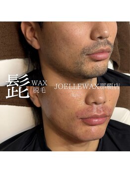 ジョエルワックス 沖縄那覇店(JOELLE WAX)/メンズ脱毛で清潔感UP