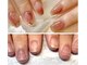 ビビネイル(BIBI Nail)の写真/【美しくなっていく自爪に感動♪】深爪・横平爪など爪の形に自信がない方も見惚れる指先に導く本格育爪★