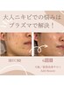 ◆ニキビ改善を目指す方はコチラ⇒肌質改善プラズマフェイシャル⇒13,500円