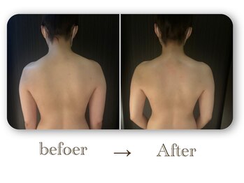 テテ(TeTe)/コリをほぐせば見た目も変わる!