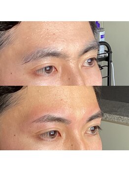 眉毛ハウス 吉祥寺店(眉毛HOUSE)/お客様の施術例(吉祥寺/東京)