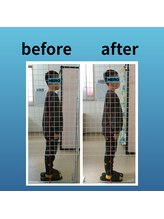 ストレッチヒーロー 米子店/ストレッチでの変化「KIDS」