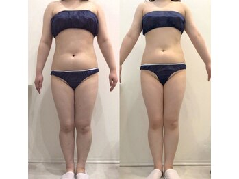 リラパドマ 千葉店(Rela Padma)/激痩せ短期集中ダイエットコース