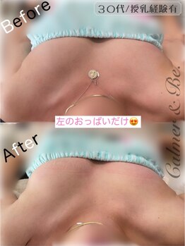 カルマーアンドビー(Calmer & Be.)/【バスト】Before/After