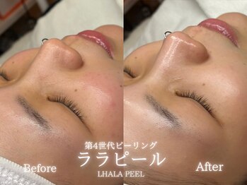 リル 和歌山市店(lilou)/ララピールBefore after☆