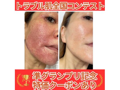 パリライム(parislime)の写真