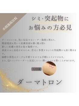 クリニカルボーテ 心斎橋院(CLINICAL BEAUTE)/シミにお悩みの方へ◎
