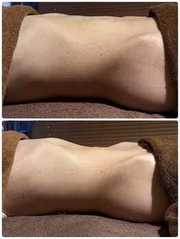 凪サロン(凪SALON)/骨盤調整&HOT腸もみもあります