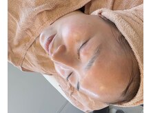 ザ ヴォーグ(the VOGUE)の雰囲気（大人女性のための"肌育"。肌質改善・美白・毛穴、）