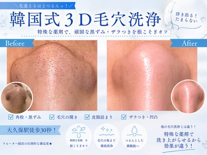 ベル(BELL)の写真