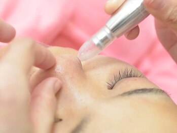 サロン ド シゲ(SALON de Shige)/毛穴ケア