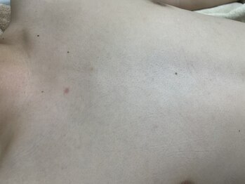 ナノハナ/鹿沼市の全身脱毛美容室ナノハナ