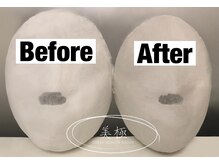 美極 トータルビューティー(美極 TOTAL BEAUTY)/恵比寿/小顔コルギ/エステ/